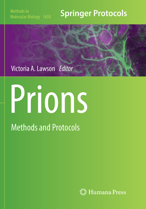 Prions - 