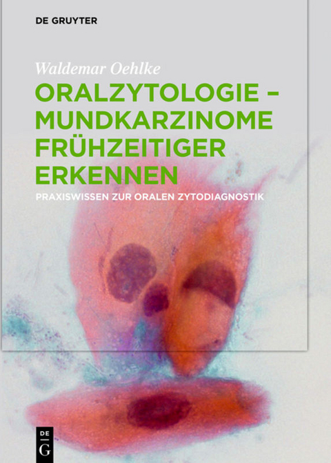 Oralzytologie - Mundkarzinome fr&uuml;hzeitiger erkennen - Waldemar Oehlke