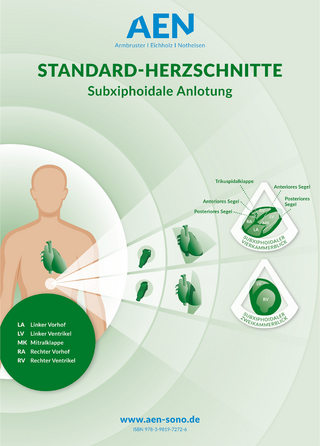 Standard-Herzschnitte Echokardiografie, Poster