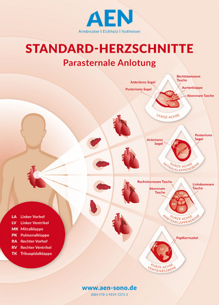Standard-Herzschnitte Echokardiografie, Poster