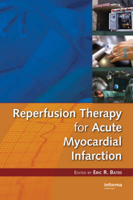 Reperfusion Therapy for Acute Myocardial Infarction - 