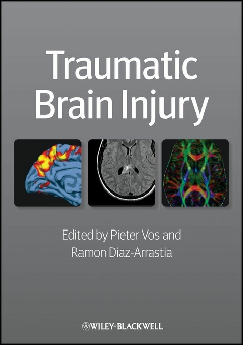 Traumatic Brain Injury - 