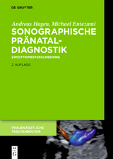 Sonographische Pr&auml;nataldiagnostik - Michael Entezami, Andreas Hagen