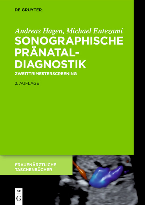 Sonographische Pr&auml;nataldiagnostik - Michael Entezami, Andreas Hagen