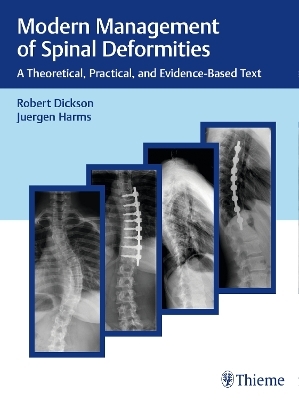 Modern Management of Spinal Deformities - Robert A. Dickson, J&uuml;rgen Harms