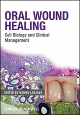 Oral Wound Healing - 