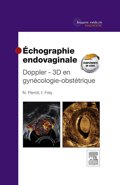 &Eacute;chographie endovaginale Doppler - 3D -  Isabelle Frey,  Nicolas Perrot