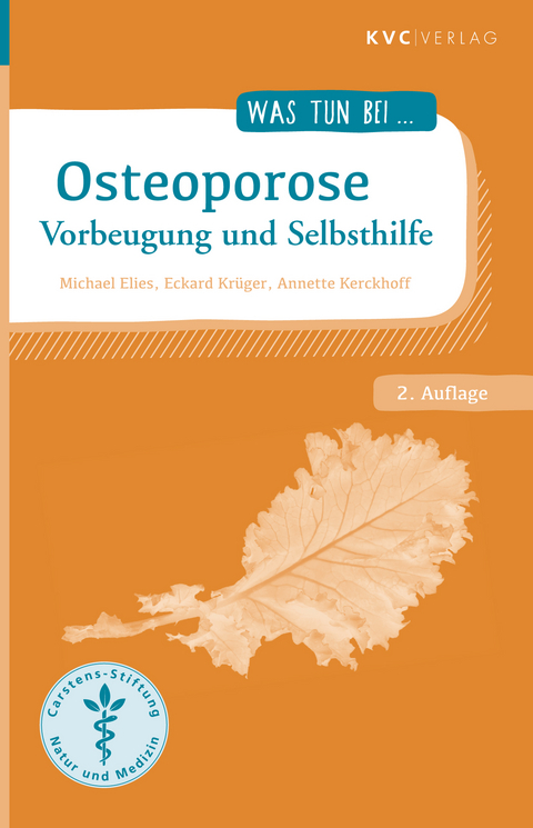 Osteoporose - Michael Elies, Eckard Kr&uuml;ger, Annette Kerckhoff