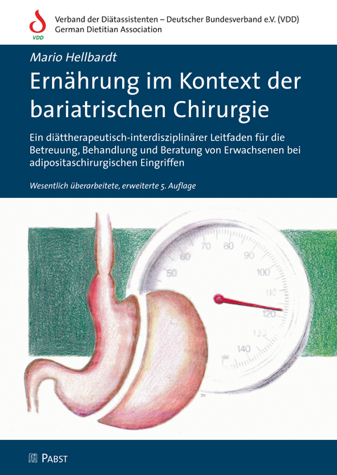 Ern&auml;hrung im Kontext der bariatrischen Chirurgie - 