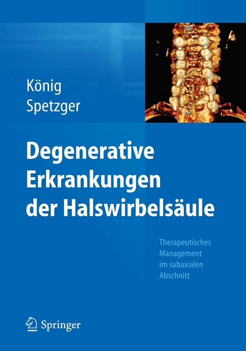 Degenerative Erkrankungen der Halswirbels&auml;ule - Stefan Alexander K&ouml;nig, Uwe Spetzger