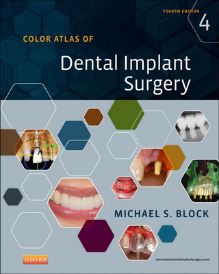 Color Atlas of Dental Implant Surgery - E-Book