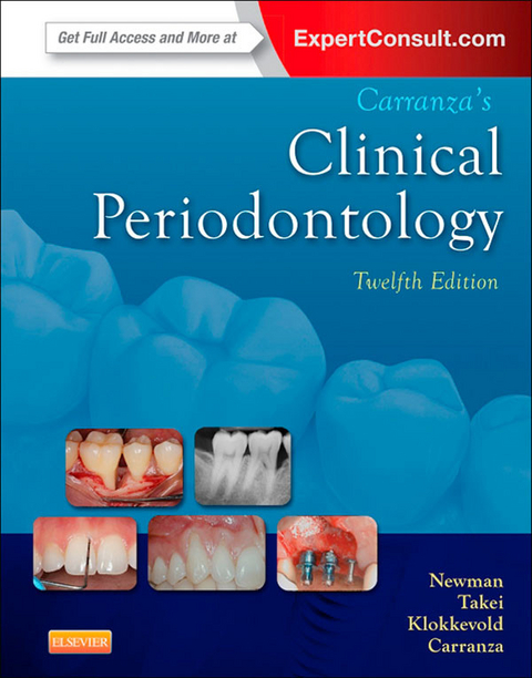 Carranza's Clinical Periodontology - E-Book -  Fermin A. Carranza,  Perry R. Klokkevold,  Michael G. Newman,  Henry Takei