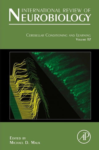Cerebellar Conditioning and Learning