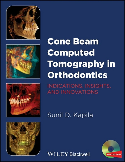 Cone Beam Computed Tomography in Orthodontics - Sunil D. Kapila