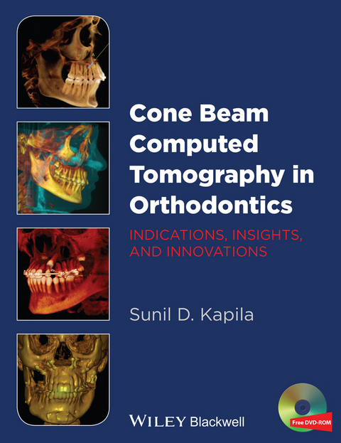 Cone Beam Computed Tomography in Orthodontics -  Sunil D. Kapila