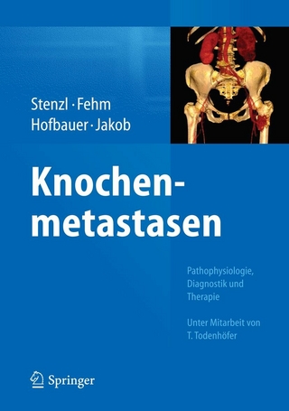 Knochenmetastasen