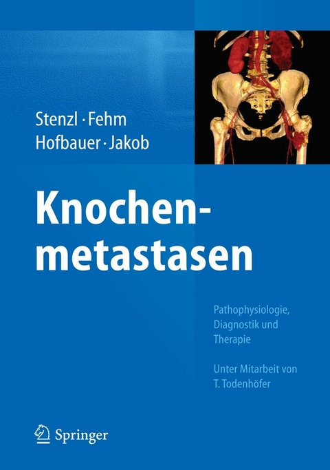 Knochenmetastasen - 