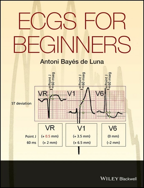 ECGs for Beginners - Antoni Bay&eacute;s de Luna