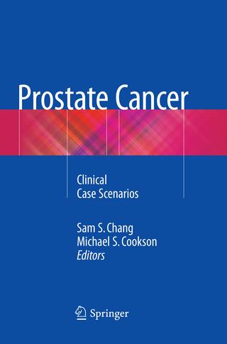 Prostate Cancer