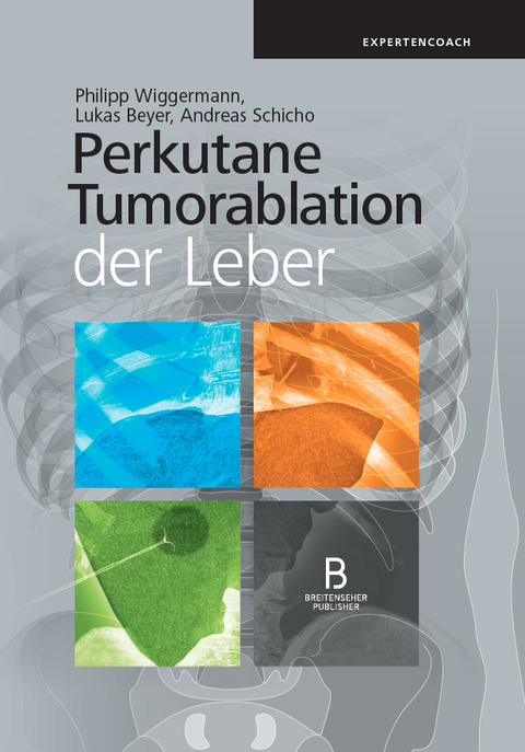 Perkutane Tumorablation der Leber - 