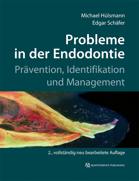Probleme in der Endodontie - Michael H&uuml;lsmann, Edgar Sch&auml;fer