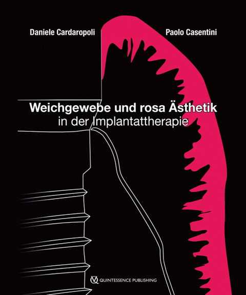 Weichgewebe und rosa &Auml;sthetik in der Implantattherapie - Daniele Cardaropoli, Paolo Casentini