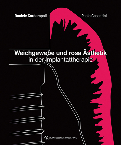 Weichgewebe und rosa Ästhetik in der Implantattherapie - Daniele Cardaropoli, Paolo Casentini