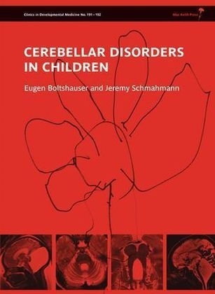 Cerebellar Disorders in Children - 