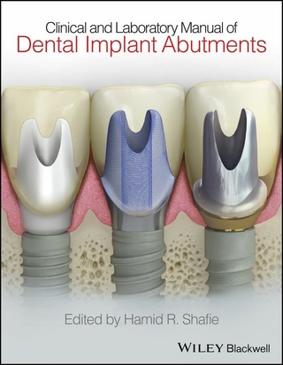 Clinical and Laboratory Manual of Dental Implant Abutments