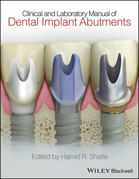 Clinical and Laboratory Manual of Dental Implant Abutments -  Hamid R. Shafie