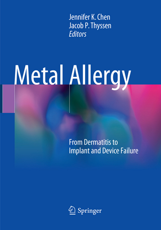 Metal Allergy