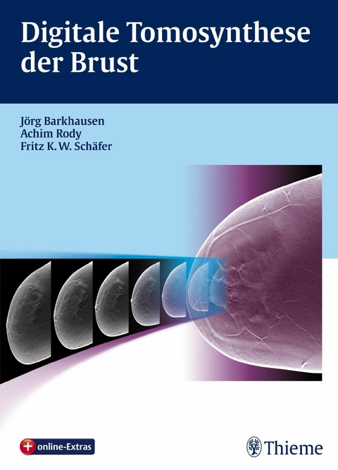 Digitale Tomosynthese der Brust - 