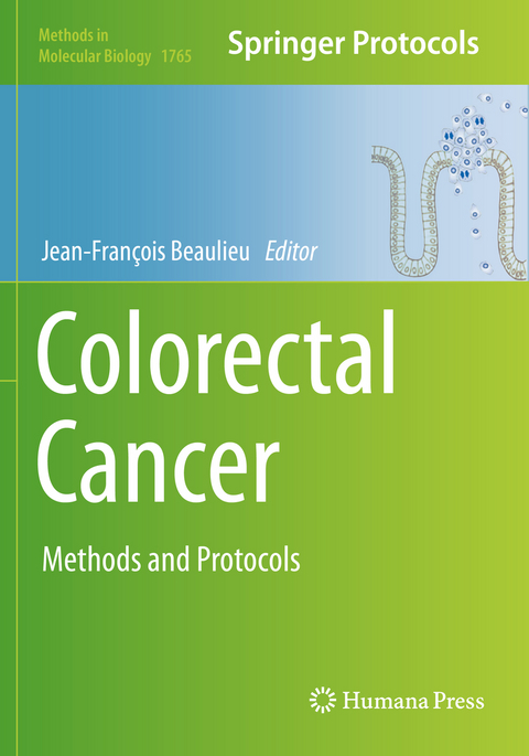 Colorectal Cancer - 