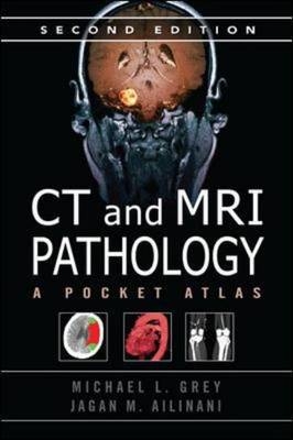 CT & MRI Pathology: A Pocket Atlas, Second Edition