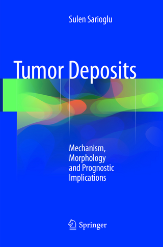 Tumor Deposits