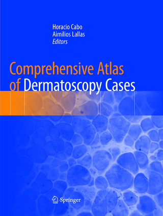 Comprehensive Atlas of Dermatoscopy Cases