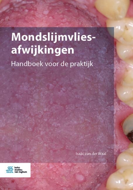 Mondslijmvliesafwijkingen - Isa&auml;c van der Waal