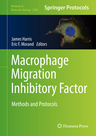 Macrophage Migration Inhibitory Factor