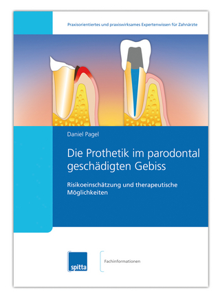 Die Prothetik im parodontal geschädigten Gebiss