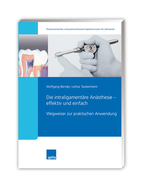 Die intraligament&auml;re An&auml;sthesie &ndash; effektiv und einfach - Wolfgang Bender, Lothar Taubenheim