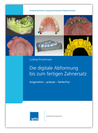Die digitale Abformung bis zum fertigen Zahnersatz