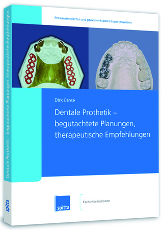 Dentale Prothetik – begutachtete Planungen, therapeutische Empfehlungen