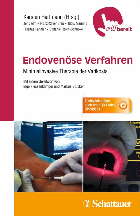 Endoven&ouml;se Verfahren -  Jens Alm,  Franz-Xaver Breu,  Uldis Maurins,  Felizitas Pannier,  Stefanie Reich-Schupke