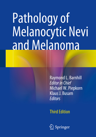 Pathology of Melanocytic Nevi and Melanoma