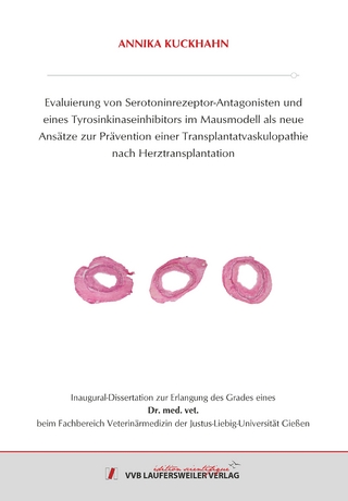 Evaluierung von Serotoninrezeptor-Antagonisten und eines Tyrosinkinaseinhibitors im Mausmodell als neue Ansätze zur Prävention einer Transplantatvaskulopathie nach Herztransplantation