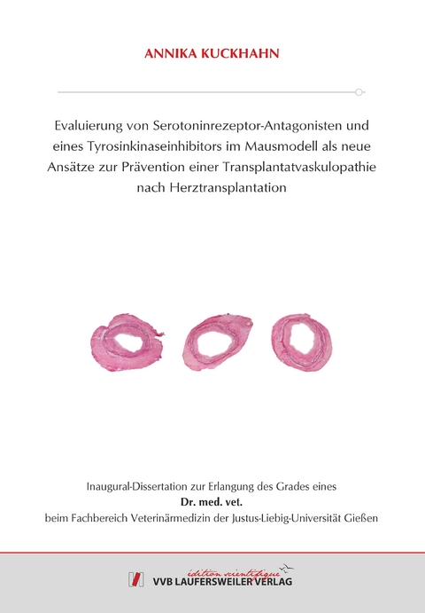 Evaluierung von Serotoninrezeptor-Antagonisten und eines Tyrosinkinaseinhibitors im Mausmodell als neue Ans&auml;tze zur Pr&auml;vention einer Transplantatvaskulopathie nach Herztransplantation - Annika Kuckhahn