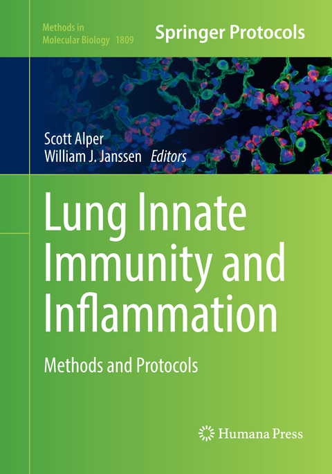 Lung Innate Immunity and Inflammation - 