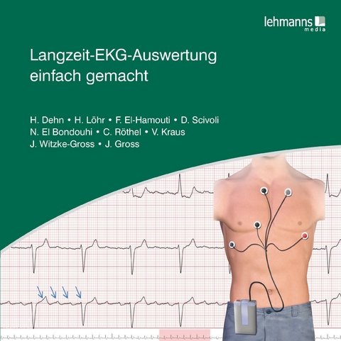 Langzeit-EKG-Auswertung einfach gemacht - Helma Dehn, Heike L&ouml;hr, Faiza El-Hamouti, Daniela Scivoli, Nora El-Bondouhi, Vanessa Kraus, Christina R&ouml;thel, Jutta Witzke-Gross, Joseph Gross