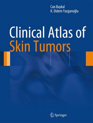 Clinical Atlas of Skin Tumors
