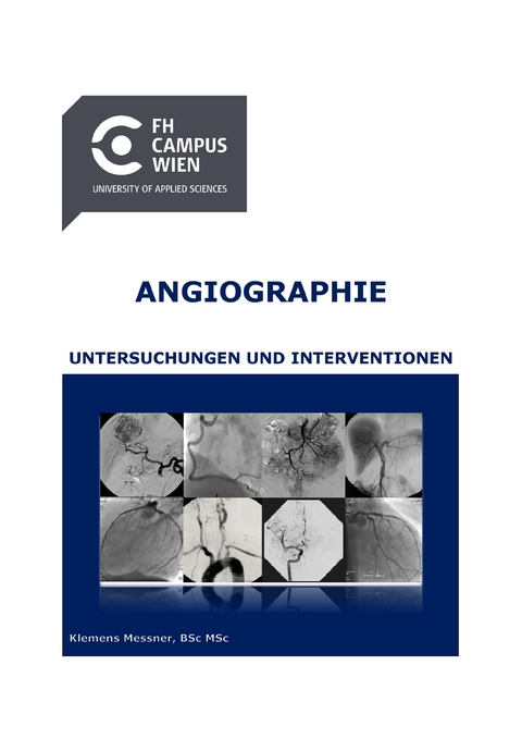 Angiographie - Untersuchungen und Interventionen - Klemens Messner